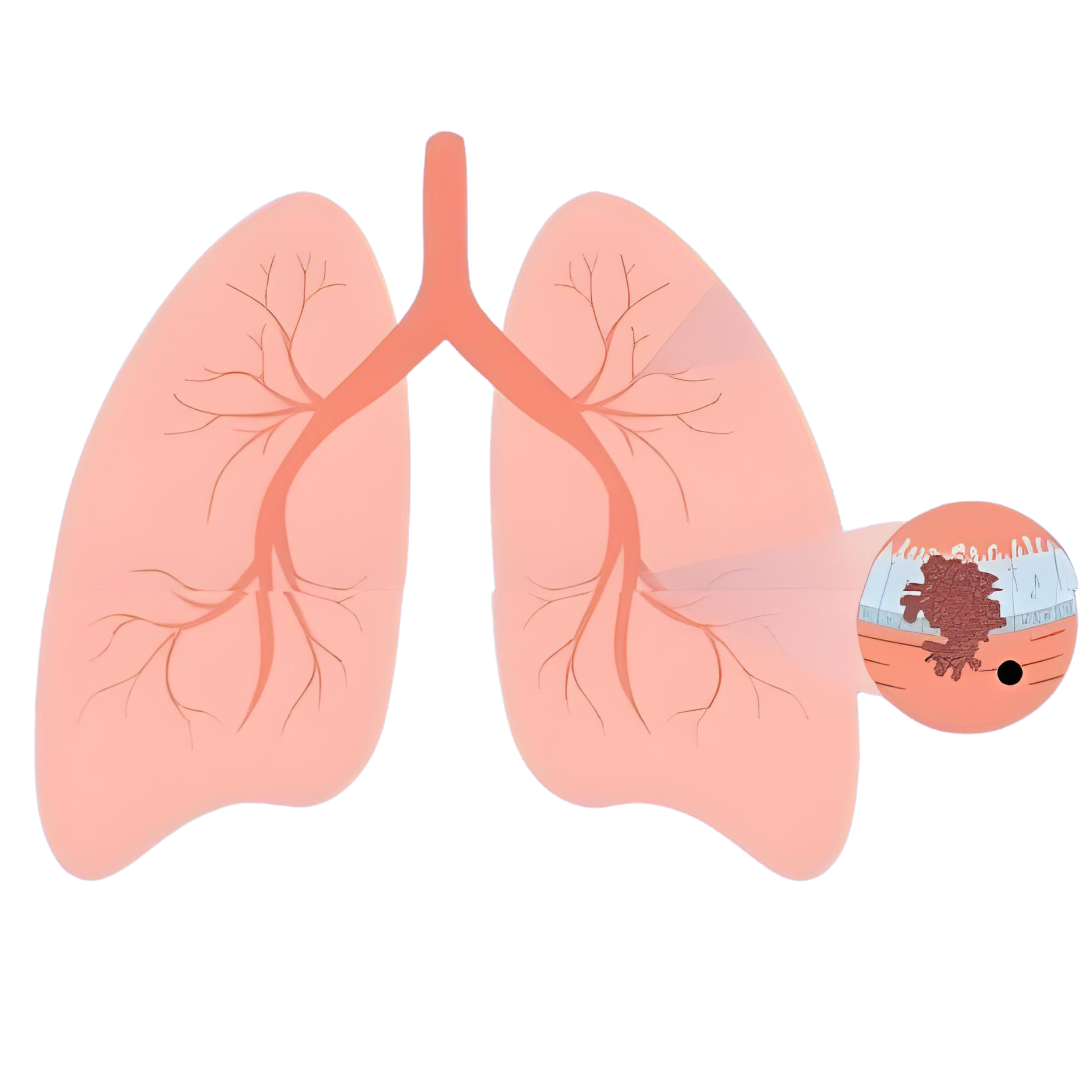 Lungs Diagram